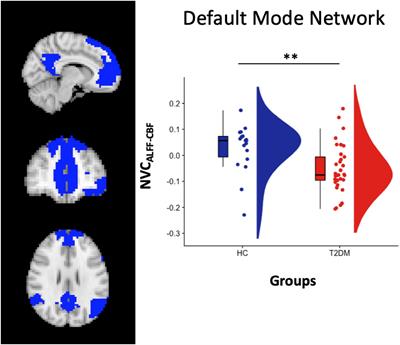 Neurovascular coupling in patients with type 2 diabetes mellitus